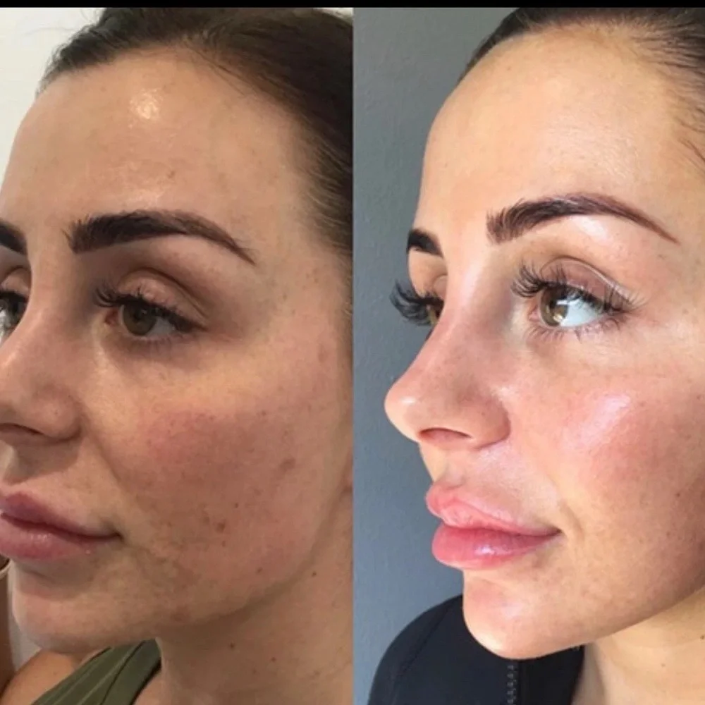 Music to My Face Lactic Acid Skincare Bottle